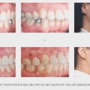 미소하나치과의원 이미지