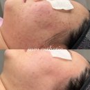 솜 에스테틱 이미지