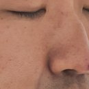 링클스탑의원 이미지