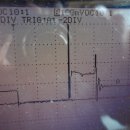 동진커먼레일 이미지