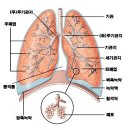진폐증(pneumoconiosis) 이미지