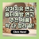 치유약국 | 상처 치유, 흉터 예방 연고, 약국·병원 추천 연고 BEST 4 완벽 비교