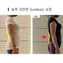 애프터메디 이미지