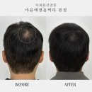마음에점을찍다두피SMP 이미지