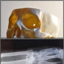 미아연세튼튼마취통증의학과의원 | 8시간 근무에도 끄떡없는 다리 만들기