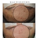 거제림 이미지