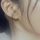 바르다성형외과의원 네이버블로그