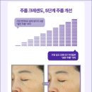 탄탄 | PDRN 세럼 탄탄 보습 후기