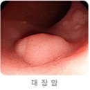 식생활의 필요악 ‘포화지방산’을 아시나요? 이미지