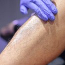 서울ND(엔디)의원 | 합정피부과 제모? ‘이것’으로 빠르게 가능합니다(18년차 전문의)