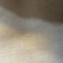 아이러브피부과의원 이미지