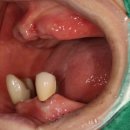 여치과기공소 이미지