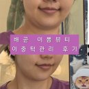 이뻐진개 | 배곧 피부관리 이뽐뷰티 이중턱관리 후기 전후비교