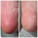 오니크네일 이미지