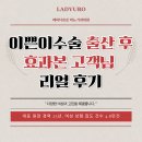 조비뇨기과의원 | 이쁜이수술 출산 후 효과본 고객님 리얼 후기