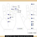 수지침 처방 - 위장질환의 수지침처방 이미지