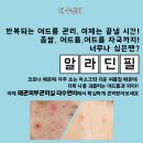 더수앤미