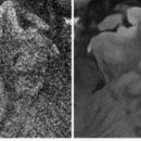 [단독] 30분 넘게 찍던 MRI, 이젠 5분이면 끝난다…국내 스타트업이 개발 이미지