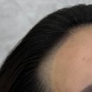 선헤어라인 이미지