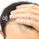 에이모가발