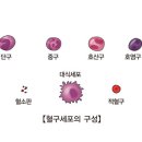 호중구 감소증 이미지