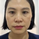 라라스킨 이미지