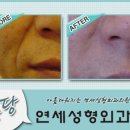 연세성형외과 이미지