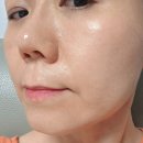 이수역 피부과 티타늄리프팅 후기 내돈내산