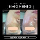 엘라인케어 네이버블로그