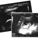 임신10개월-한눈에 보는 임신 40주 이미지