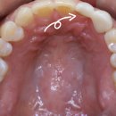 주안치과기공소 이미지