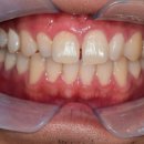 이건치과기공소 이미지