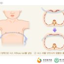 오목이네