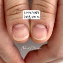 손톱교정 소요기간/대전세종손톱교정 아크릴네일후기 1회만으로 완성가능해요!