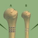 피티온도 이미지