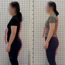 오리필라테스 | [둔산동 필라테스] 20대 여성 오리엉덩이 체형교정 후기 (100% 실제 전/후 사진有)