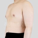 진성환경 | 사이먼 그레이드 2A, 진성 여유증수술 경과 2개월 후기