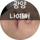 리베종합화장품 | 모공축소+피부결개선,트라이엄레이저 효과 대공개! #광양나예뻐<맛집,체험>