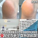 올발은 네일(all발은 네일) | 창원네일샵 오로지푸스 문제성 발관리 전문 발각질 관리받고 온 후기