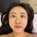 제이에이치한바구니 - 수영구 수영로 701-1 | [피부관리] 삼전역 피부관리 올가드림뷰티 삼전역점 관리받은 후기