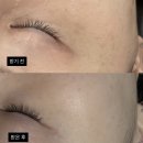 선기로1-6 | [부천/상동] 써니뷰티 부천상동점_ 기미,주근깨 색소개선 올인원케어 미백관리 후기