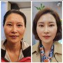 피부미인(인셀덤) 이미지