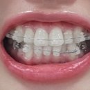 서울범어치과교정과치과의원 이미지