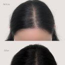 화인헤어 - 거제시 서문로3길 11 | 정수리 두피문신 '화인' 가르마 완벽 커버! 부작용 전혀 없는 자연스러운 SMP 솔직후기