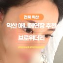 애니브로