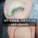 문제성 손발톱 전문관리 케어톱톱