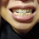 스탠다드치과 | 스탠다드145 브리즈온 윈드홀 바람칫솔,잇몸칫솔 사용후기