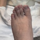 풋스올종로 | 종로발관리 풋스올 종로광화문점 후기 종로 발톱무좀