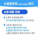 강동구 눈물길 치료는 봄의약속안과 하남시 미사강변도시 이미지