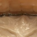 하이치과기공소 이미지